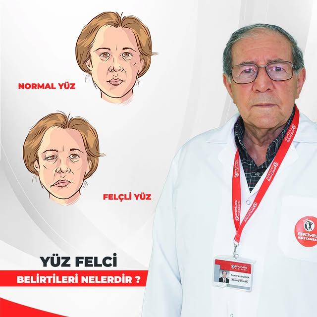 Yüz Felci Nedir, Nedenleri ve Tedavi Süreci Hakkında Bilmeniz Gerekenler