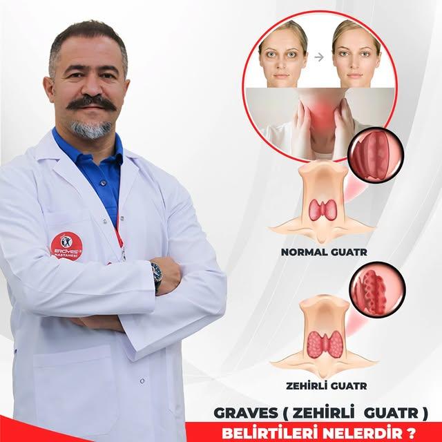 Erciyes Kartal Hastanesinden Graves Hastalığı Hakkında Bilgilendirme